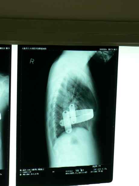 20051108_2.JPG